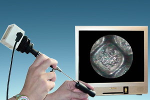 Endoscopi ottici e video