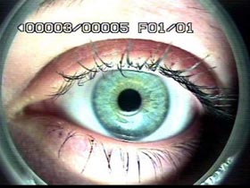 Examples in the ophthalmic sector