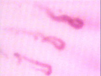 Immagine di capillari migliorata col software Giotto