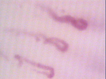 Image of capillaries
